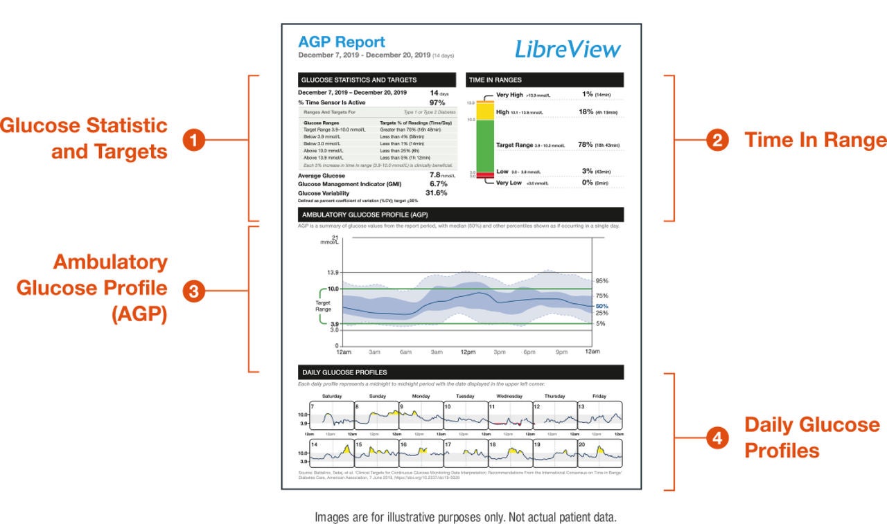 Ambulatory Glucose Profile | Suisse | Professionnels de santé | Abbott