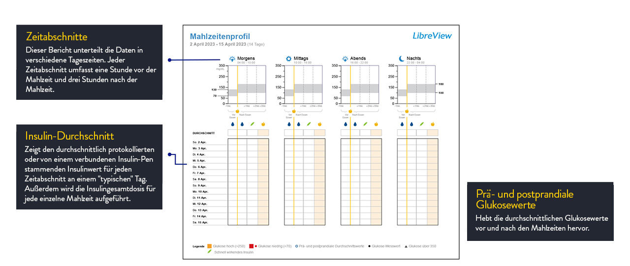 Abbildung Mahlzeitenprofil
