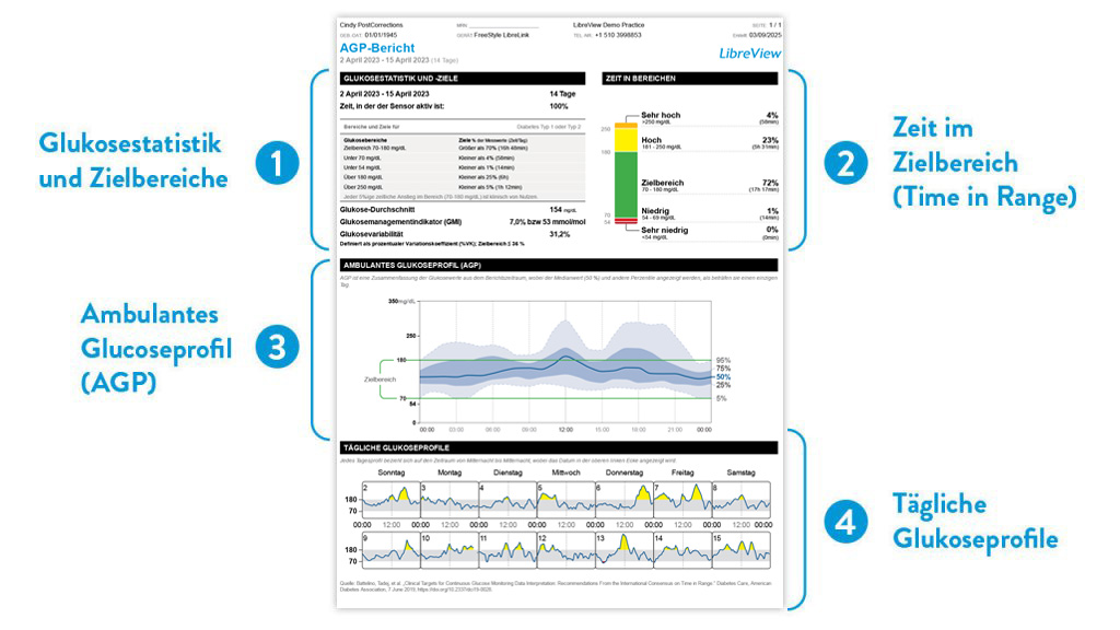 Infografik: Mit LibreView die Zeit im Zielbereich und das Ambulante Glukoseprofil visualisieren