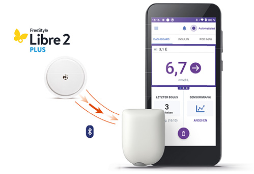 Unser Sensor und Omnipod® 5 schaffen  ein einfaches, integriertes Erlebnis