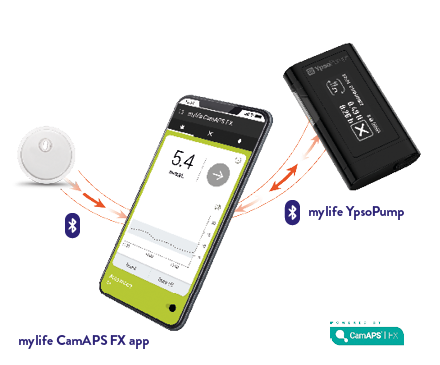 Der FreeStyle Libre 3 Sensor und das mylife Loop System zur automatisierten Insulinabgabe