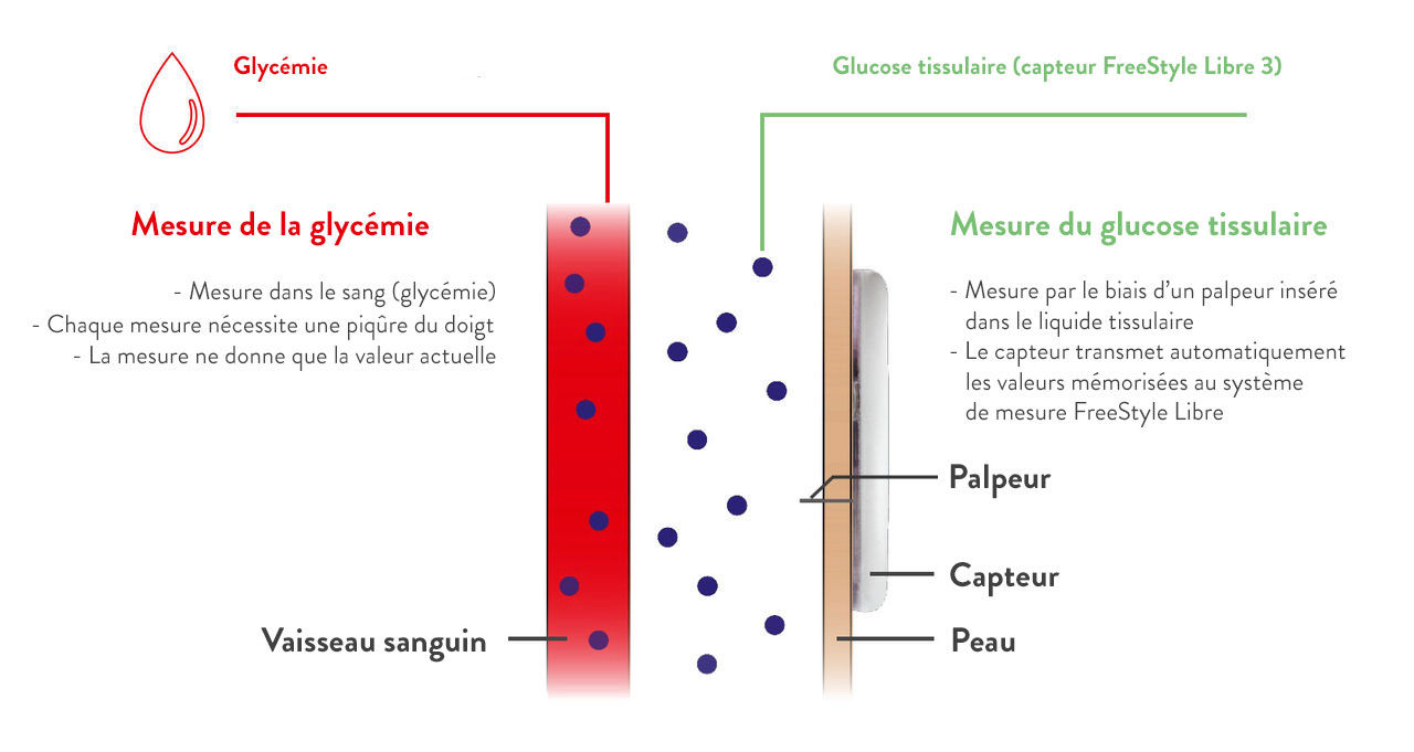 Quelle est la différence entre la mesure continue du glucose par capteur et la mesure de la glycémie?