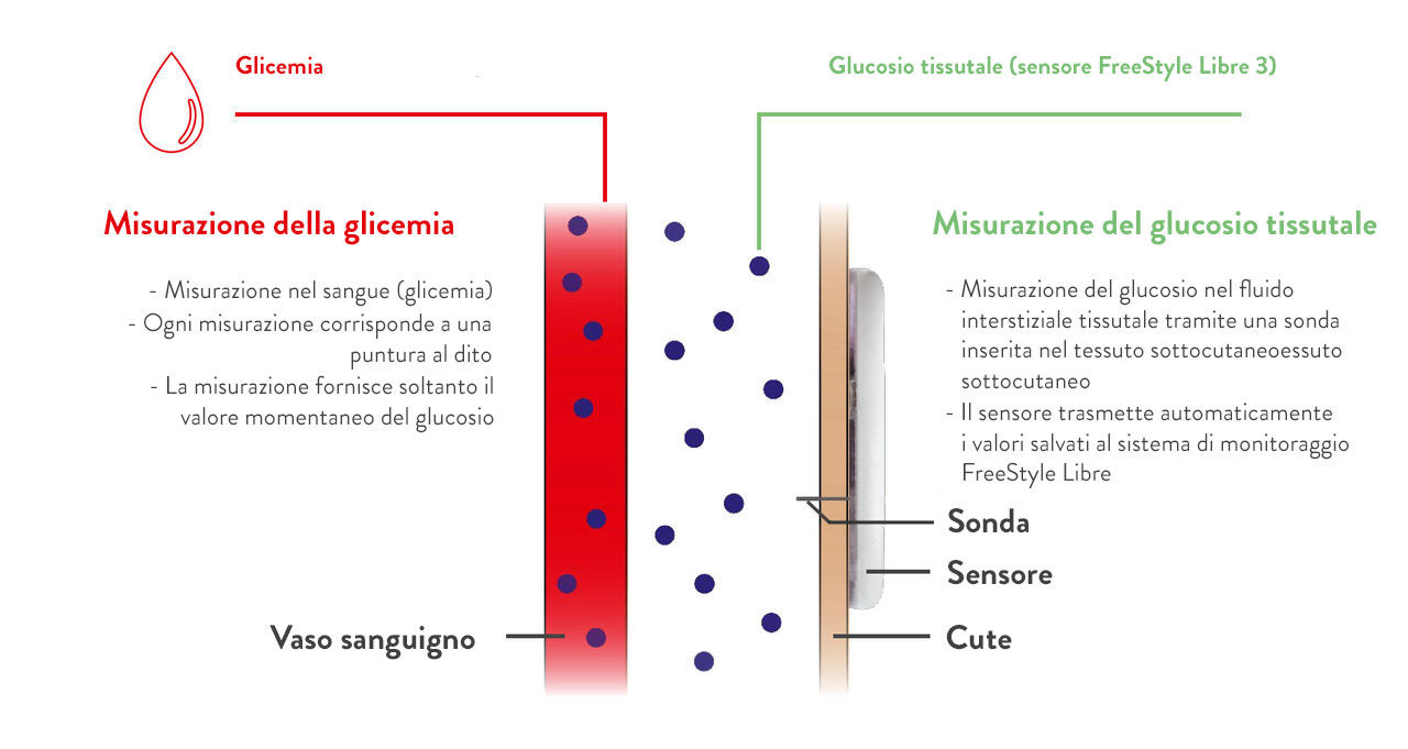 Qual è la differenza tra monitoraggio continuo del glucosio basato su sensore e misurazione della glicemia?