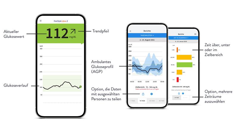 Infografik: Screenshots FreeStyle Libre App mit Erklärung der Funktionen und Anzeigen