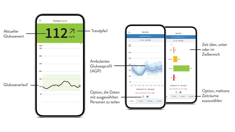 Infografik: Screenshots FreeStyle Libre App mit Erklärung der Funktionen und Anzeigen