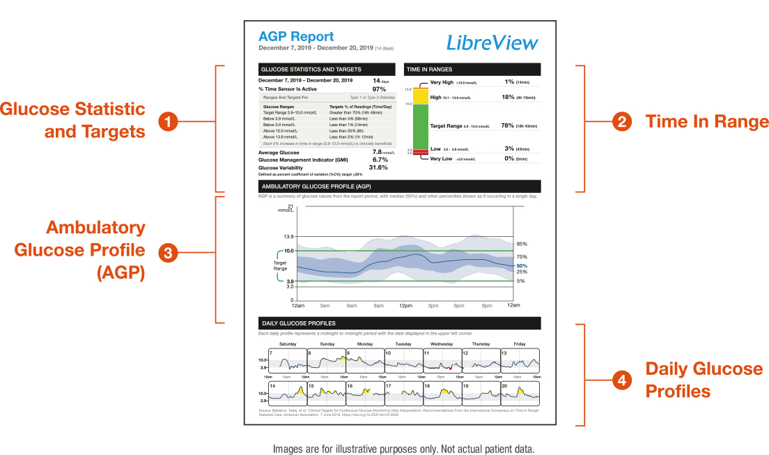 AGP Report representation in LibreView.