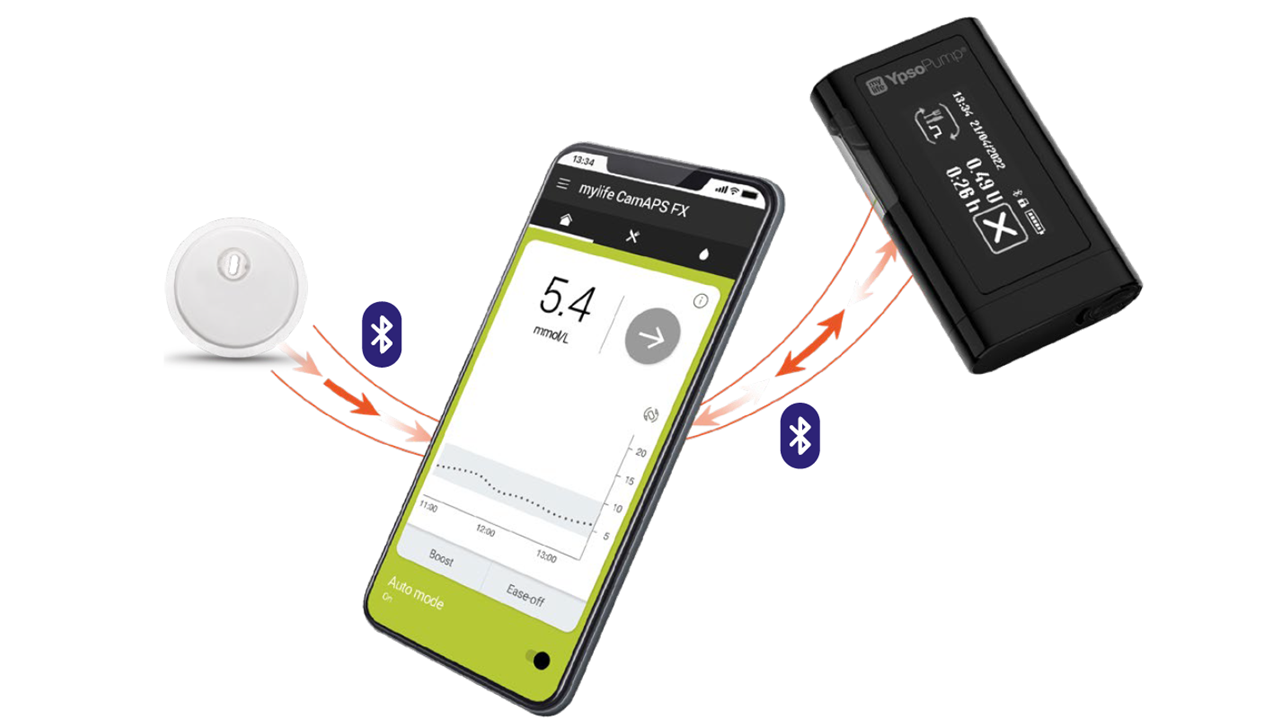 myLoop AID-systeem