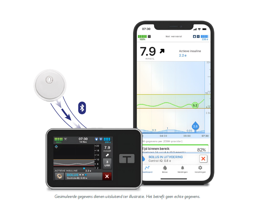 FreeStyle Libre 3 Plus-sensor met Tandem t:slim X2 insulinepomp