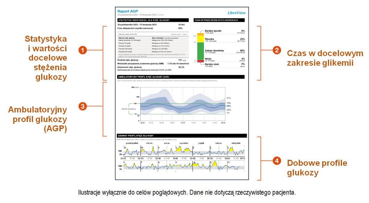 TIR AGP chart