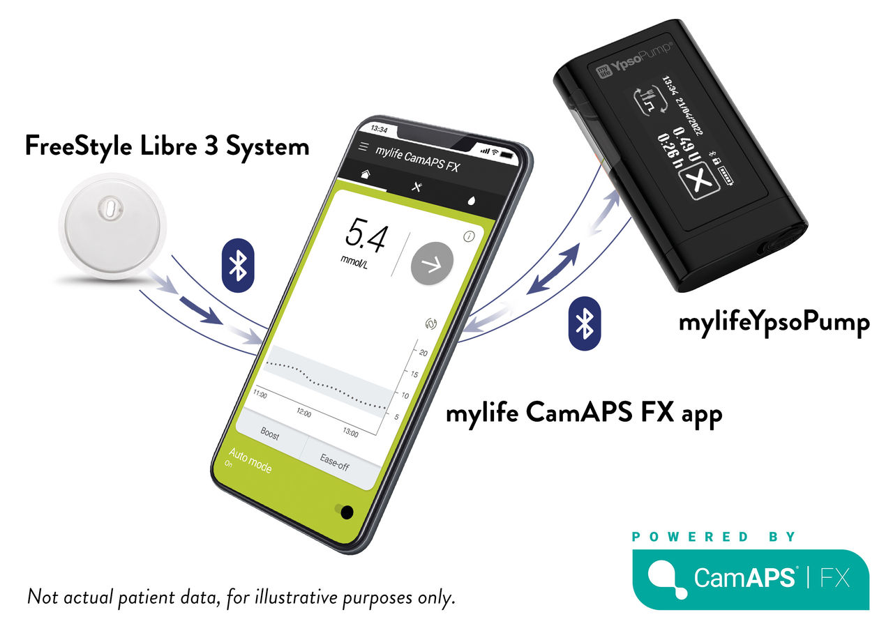 The FreeStyle Libre 3 sensor working with the mylife Loop AID system