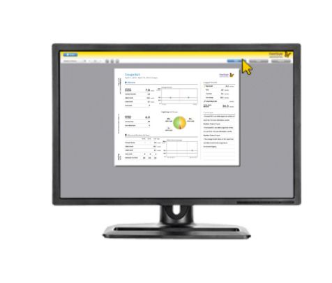 Create report